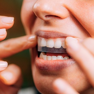 Patient putting on whitening strip