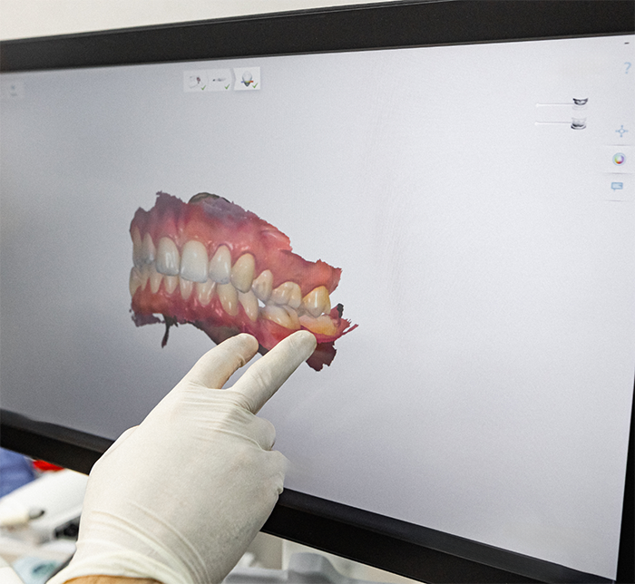 Dentist pointing to a scan of a patient's teeth